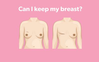 "Can I keep my breast?"